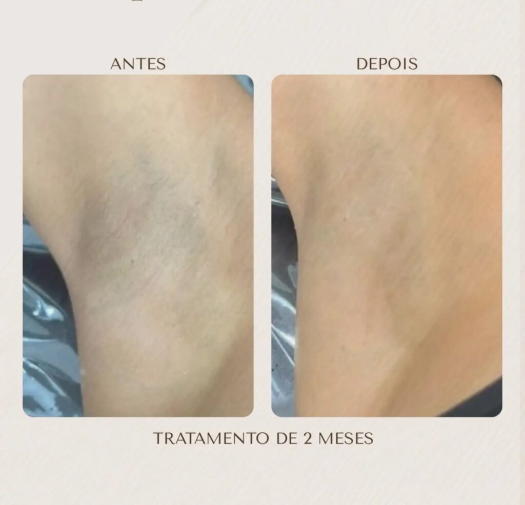 img 20260715 233630